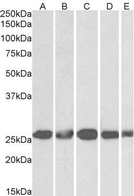 Goat anti-CSNK2B Antibody