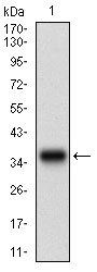 CSNK2B Antibody