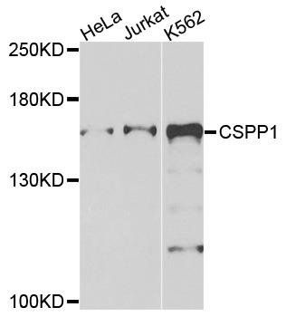 CSPP1 antibody
