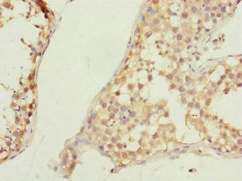 CSPP1 Antibody