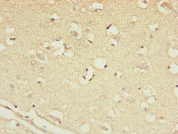 CSPP1 Antibody