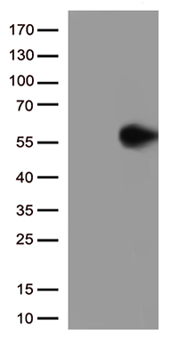CSPS (SULT1A3) antibody