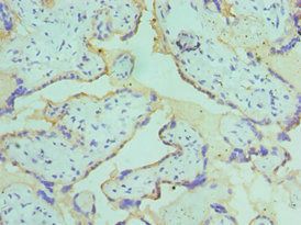 CSRNP1 Antibody