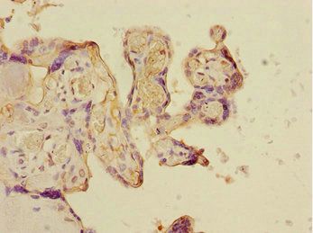 CSRNP2 Antibody