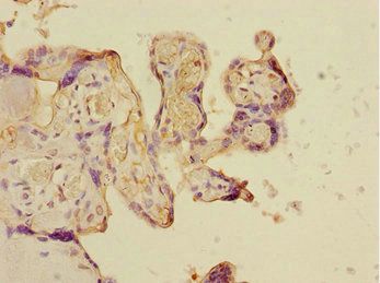 CSRNP2 antibody