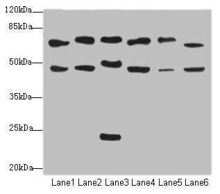 CSRNP2 Antibody