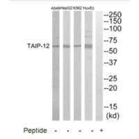 CSRNP2 antibody