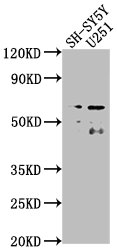 CSRNP3 antibody