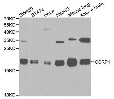 CSRP1 antibody