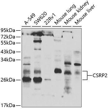CSRP2 antibody