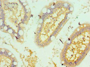 CSRP2BP antibody