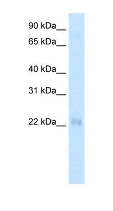 CSRP3 antibody