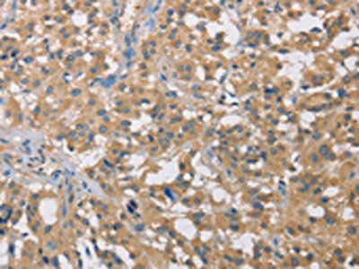 CST2 Antibody