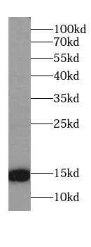CST2-Specific antibody