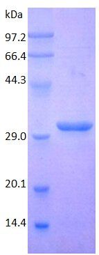 Cystatin C protein