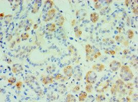 CST4 Antibody