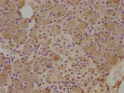 CST5 antibody