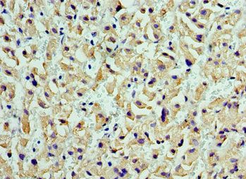 CST7 antibody