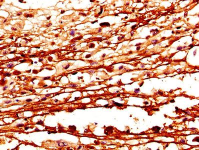 CSTA Antibody