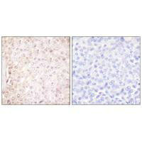 CSTB Antibody