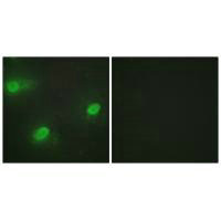 CSTF2 Antibody