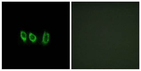 CSTL1 antibody