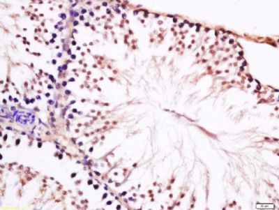 CT45A3 antibody