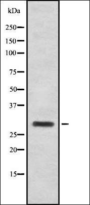 CT47A antibody