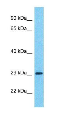 CT47A12 antibody