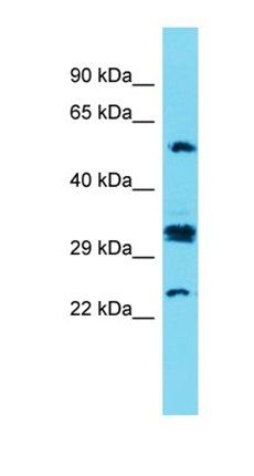 CT47A7 antibody