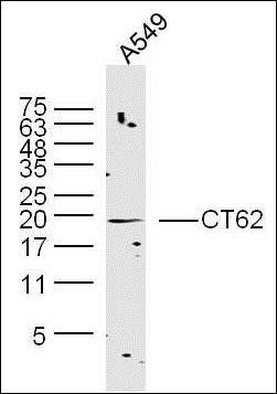 CT62 antibody