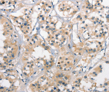 CTAG1A antibody