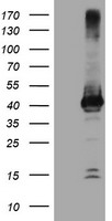 CTBP1-DT antibody