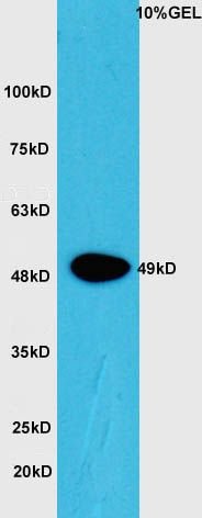 CTBP1 (Phospho-Ser422) antibody