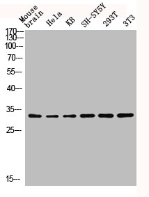 CTDSP1 Antibody