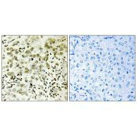 CTDSP1 Antibody