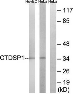 CTDSP1 antibody