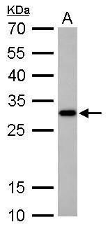 CTD small phosphatase 2 Antibody