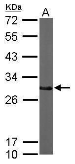 CTDSP2 Rabbit Polyclonal Antibody