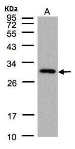 CTDSP2 Rabbit Polyclonal Antibody