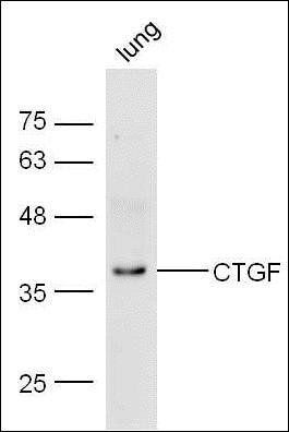 CTGF Rabbit Polyclonal Antibody