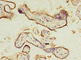 CTHRC1 Antibody