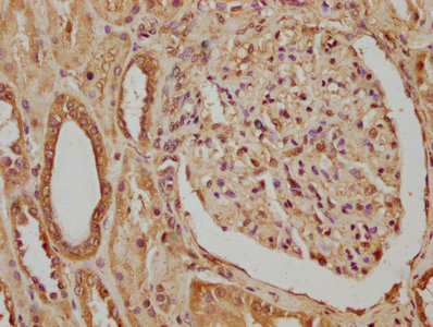 CTHRC1 antibody