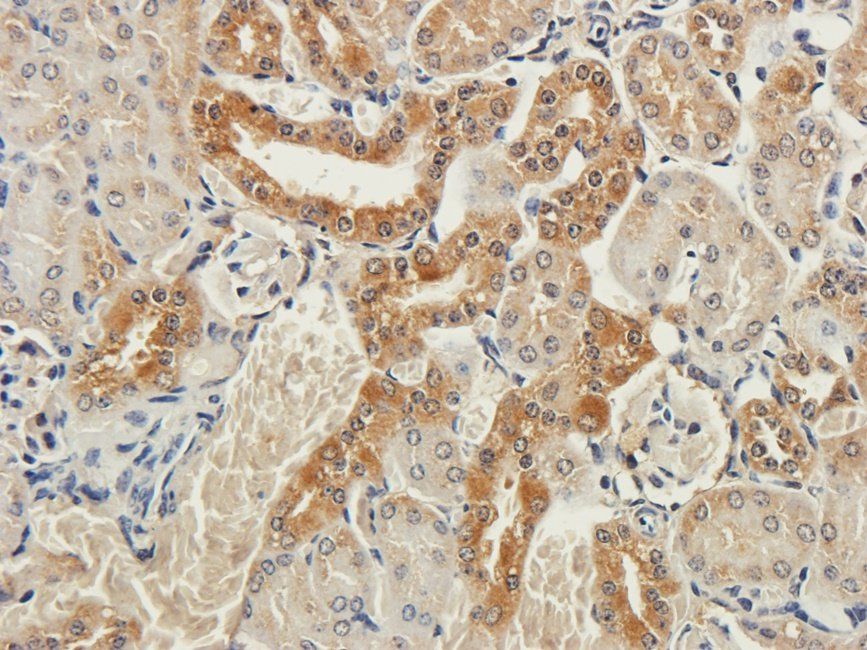 CTLA4 antibody