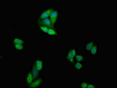 CTLA4 antibody