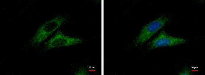 CTNNAL1 antibody [N3C2], Internal