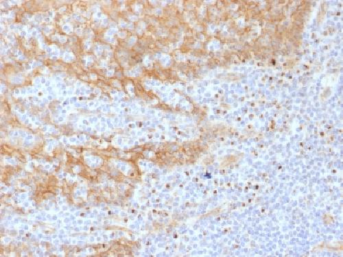Catenin, beta (p120) Antibody
