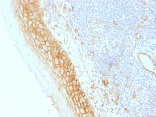 Catenin, beta (p120) Antibody