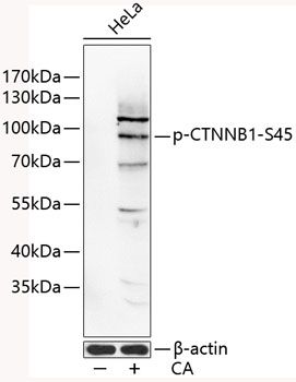 CTNNB1 (Phospho-S45) antibody