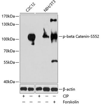 CTNNB1 (Phospho-S552) antibody